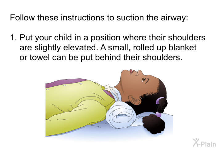 Follow these instructions to suction the airway:  Put your child in a position where their shoulders are slightly elevated. A small, rolled up blanket or towel can be put behind their shoulders.