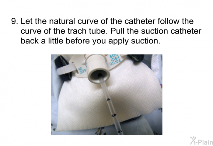 Let the natural curve of the catheter follow the curve of the trach tube. Pull the suction catheter back a little before you apply suction.