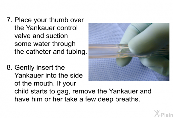 Place your thumb over the Yankauer control valve and suction some water through the catheter and tubing. Gently insert the Yankauer into the side of the mouth. If your child starts to gag, remove the Yankauer and have him or her take a few deep breaths.