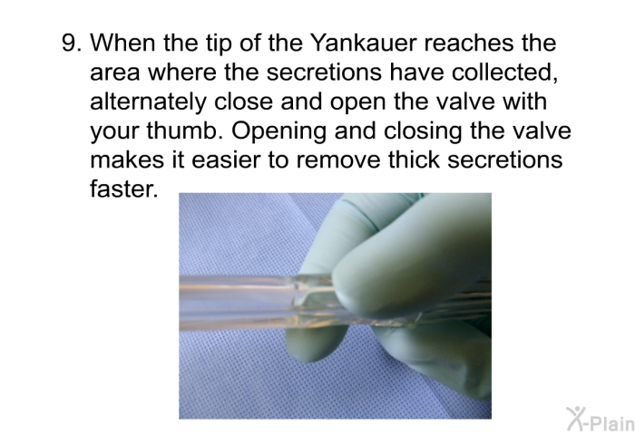 When the tip of the Yankauer reaches the area where the secretions have collected, alternately close and open the valve with your thumb. Opening and closing the valve makes it easier to remove thick secretions faster.