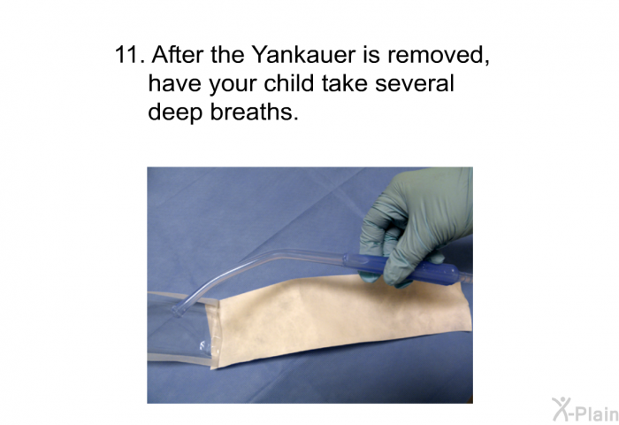 After the Yankauer is removed, have your child take several deep breaths.