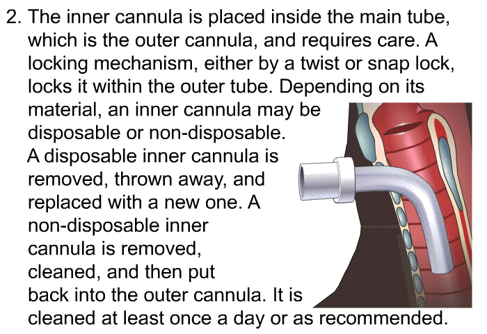 The inner cannula is placed inside the main tube, which is the outer cannula, and requires care. A locking mechanism, either by a twist or snap lock, locks it within the outer tube. Depending on its material, an inner cannula may be disposable or non-disposable. 
A disposable inner cannula is removed, thrown away, and replaced with a new one. A non-disposable inner cannula is removed, cleaned, and then put back into the outer cannula. It is cleaned at least once a day or as recommended.