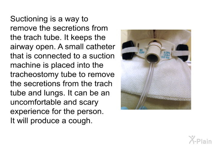 Suctioning is a way to remove the secretions from the trach tube. It keeps the airway open. A small catheter that is connected to a suction machine is placed into the tracheostomy tube to remove the secretions from the trach tube and lungs. It can be an uncomfortable and scary experience for the person. It will produce a cough.