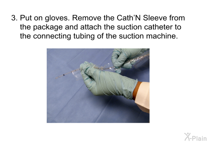 Put on gloves. Remove the Cath'N Sleeve from the package and attach the suction catheter to the connecting tubing of the suction machine.