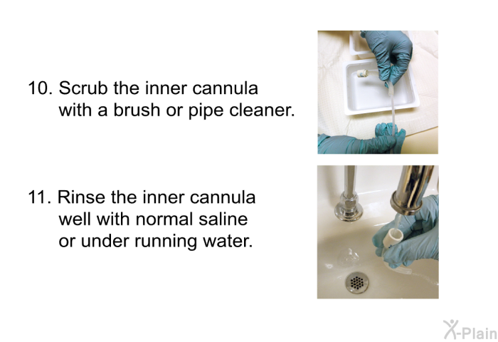 Scrub the inner cannula with a brush or pipe cleaner. Rinse the inner cannula well with normal saline or under running water.