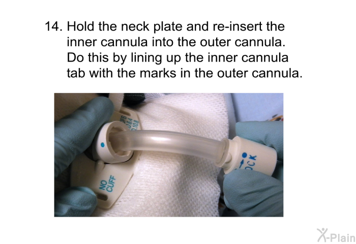 <OL START=14> Hold the neck plate and re-insert the inner cannula into the outer cannula. Do this by lining up the inner cannula tab with the marks in the outer cannula.