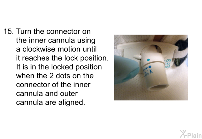 <OL START=15> Turn the connector on the inner cannula using a clockwise motion until it reaches the lock position. It is in the locked position when the 2 dots on the connector of the inner cannula and outer cannula are aligned.
