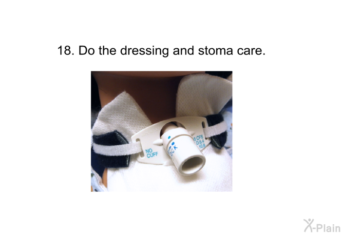 <OL START=18> Do the dressing and stoma care.