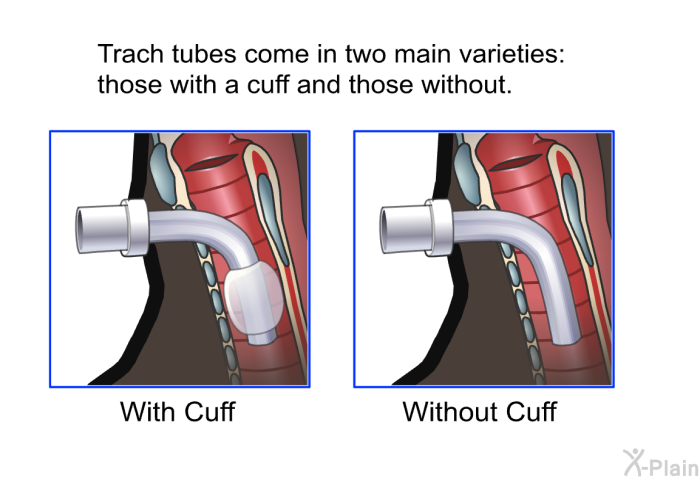 Trach tubes come in two main varieties: those with a cuff and those without.