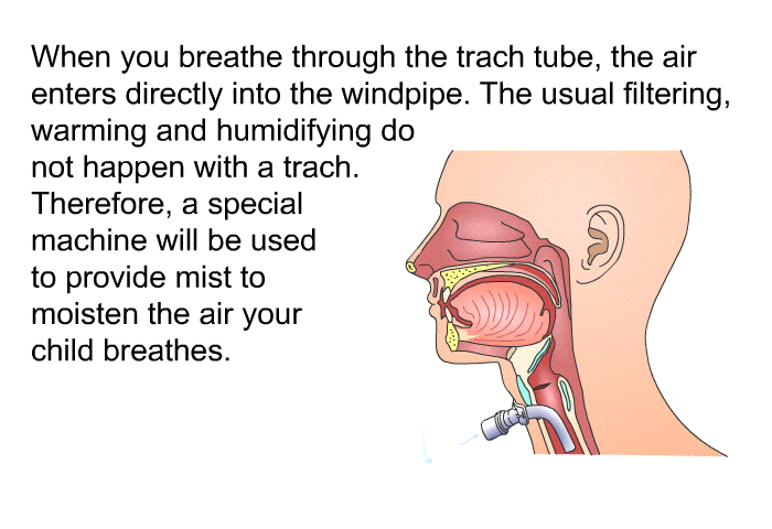 When you breathe through the trach tube, the air enters directly into the windpipe. The usual filtering, warming and humidifying do not happen with a trach. Therefore, a special machine will be used to provide mist to moisten the air your child breathes.