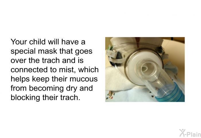 Your child will have a special mask that goes over the trach and is connected to mist, which helps keep their mucous from becoming dry and blocking their trach.