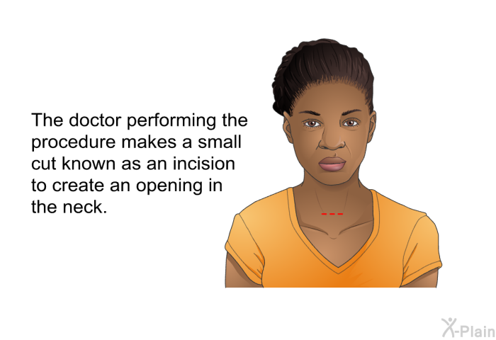 The doctor performing the procedure makes a small cut known as an incision to create an opening in the neck.