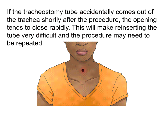 If the tracheostomy tube accidentally comes out of the trachea shortly after the procedure, the opening tends to close rapidly. This will make reinserting the tube very difficult and the procedure may need to be repeated.