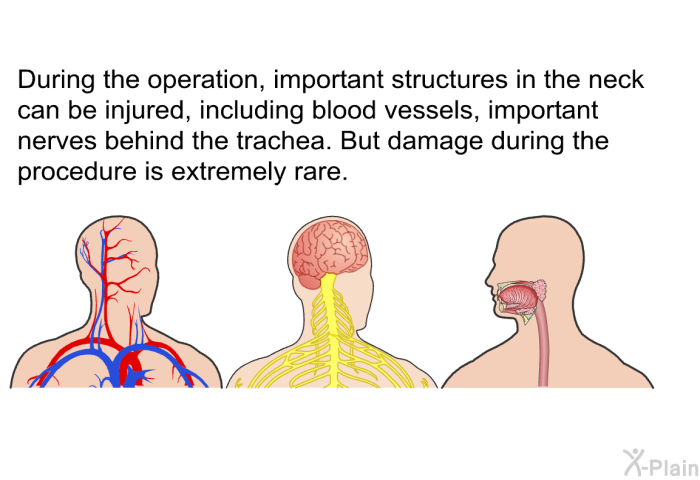 During the operation, important structures in the neck can be injured, including blood vessels, important nerves behind the trachea. But damage during the procedure is extremely rare.