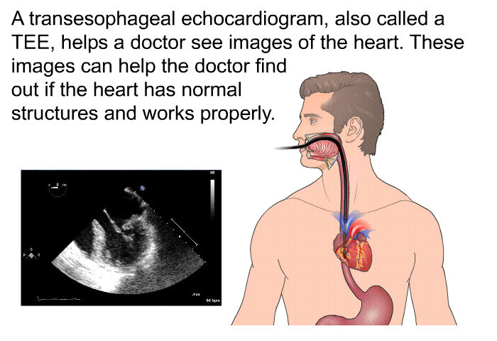 A transesophageal echocardiogram, also called a TEE, helps a doctor see images of the heart. These images can help the doctor find out if the heart has normal structures and works properly.