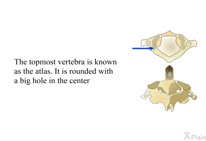 The topmost vertebra is known as the atlas. It is rounded with a big hole in the center
