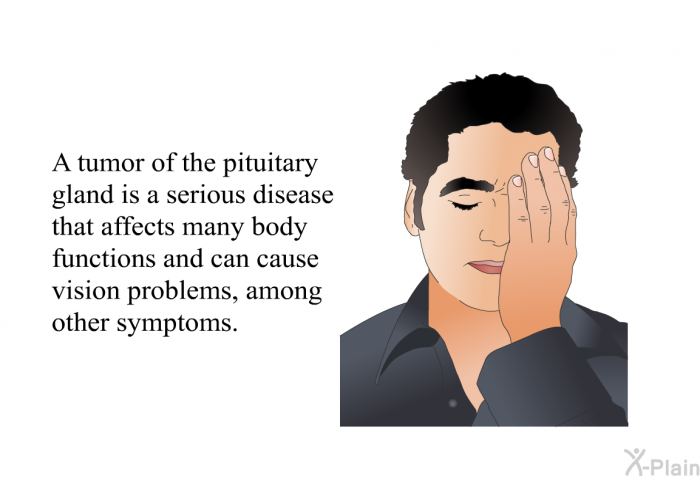 A tumor of the pituitary gland is a serious disease that affects many body functions and can cause vision problems, among other symptoms.