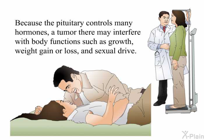 Because the pituitary controls many hormones, a tumor there may interfere with body functions such as growth, weight gain or loss, and sexual drive.