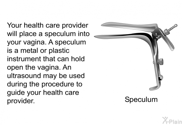 Your health care provider will place a speculum into your vagina. A speculum is a metal or plastic instrument that can hold open the vagina. An ultrasound may be used during the procedure to guide your health care provider.