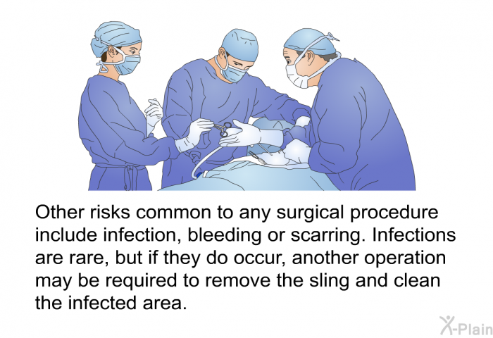 Other risks common to any surgical procedure include infection, bleeding or scarring. Infections are rare, but if they do occur, another operation may be required to remove the sling and clean the infected area.