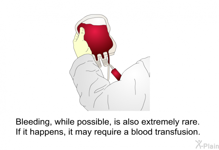 Bleeding, while possible, is also extremely rare. If it happens, it may require a blood transfusion.