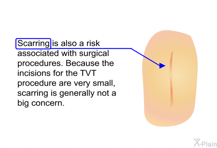 Scarring is also a risk associated with surgical procedures. Because the incisions for the TVT procedure are very small, scarring is generally not a big concern.