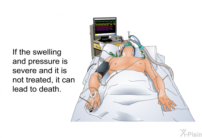 If the swelling and pressure is severe and it is not treated, it can lead to death.