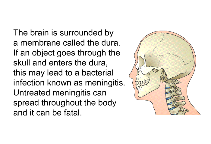 The brain is surrounded by a membrane called the dura. If an object goes through the skull and enters the dura, this may lead to a bacterial infection known as meningitis. Untreated meningitis can spread throughout the body and it can be fatal.