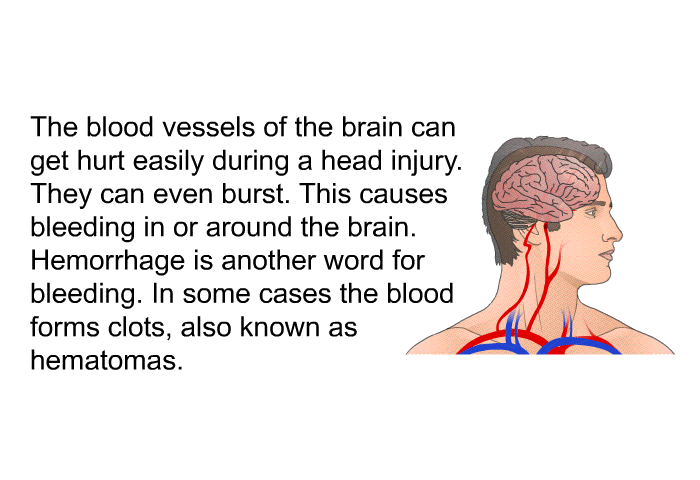 The blood vessels of the brain can get hurt easily during a head injury. They can even burst. This causes bleeding in or around the brain. Hemorrhage is another word for bleeding. In some cases the blood forms clots, also known as hematomas.