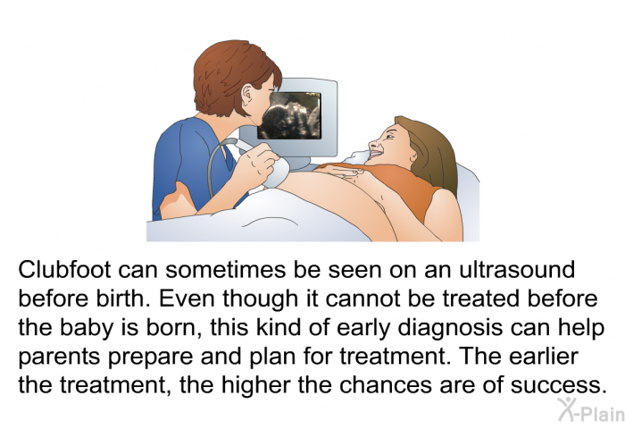 Clubfoot can sometimes be seen on an ultrasound before birth. Even though it cannot be treated before the baby is born, this kind of early diagnosis can help parents prepare and plan for treatment. The earlier the treatment, the higher the chances are of success.