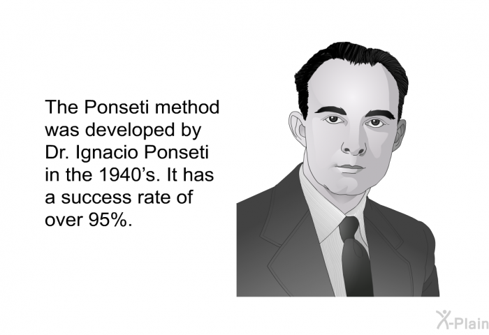 The Ponseti method was developed by Dr. Ignacio Ponseti in the 1940's. It has a success rate of over 95%.