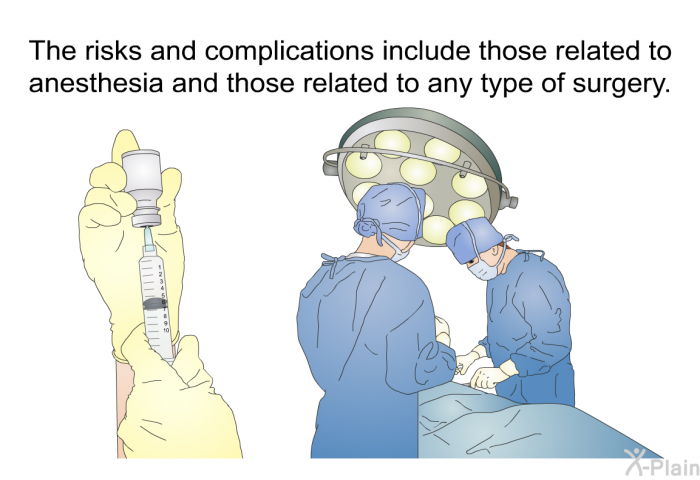 The risks and complications include those related to anesthesia and those related to any type of surgery.