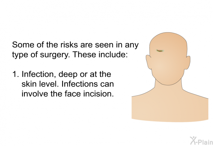 Some of the risks are seen in any type of surgery. These include:  Infection, deep or at the skin level. Infections can involve the face incision.