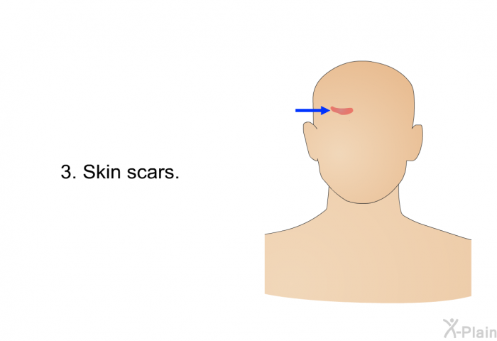 Skin scars.