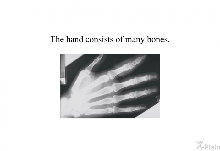 The hand consists of many bones.