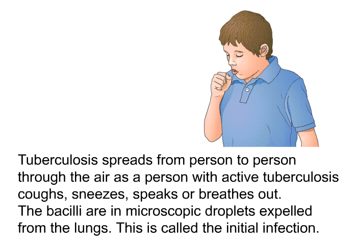 Tuberculosis spreads from person to person through the air as a person with active tuberculosis coughs, sneezes, speaks or breathes out. The bacilli are in microscopic droplets expelled from the lungs. This is called the initial infection.