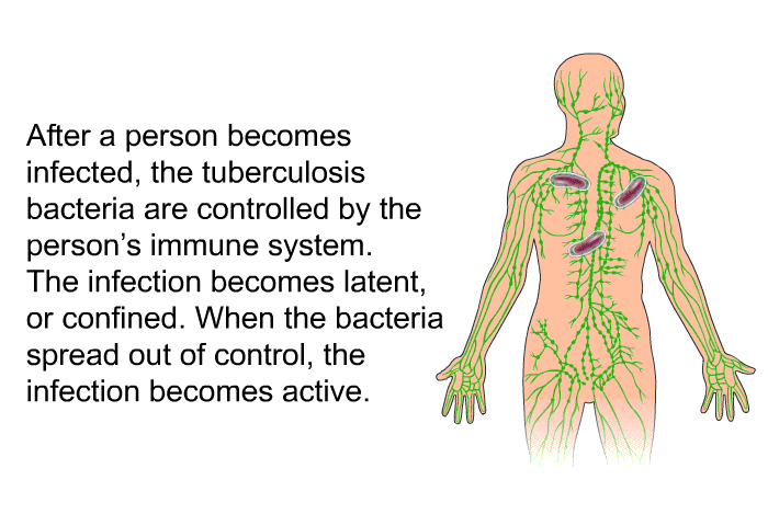 After a person becomes infected, the tuberculosis bacteria are controlled by the person's immune system. The infection becomes latent, or confined. When the bacteria spread out of control, the infection becomes active.