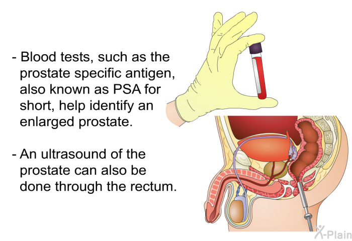 Blood tests, such as the prostate specific antigen, also known as PSA for short, help identify an enlarged prostate. An ultrasound of the prostate can also be done through the rectum.
