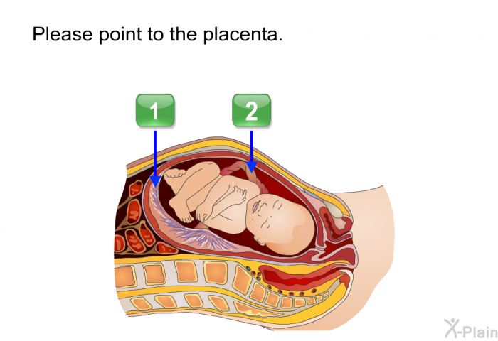 Please point to the placenta.