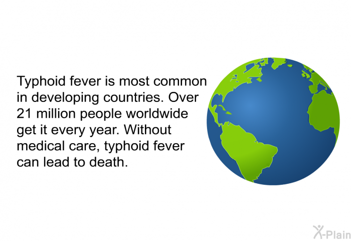 Typhoid fever is most common in developing countries. Over 21 million people worldwide get it every year. Without medical care, typhoid fever can lead to death.