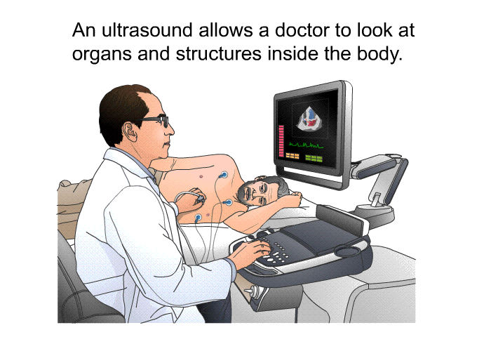 An ultrasound allows a doctor to look at organs and structures inside the body.