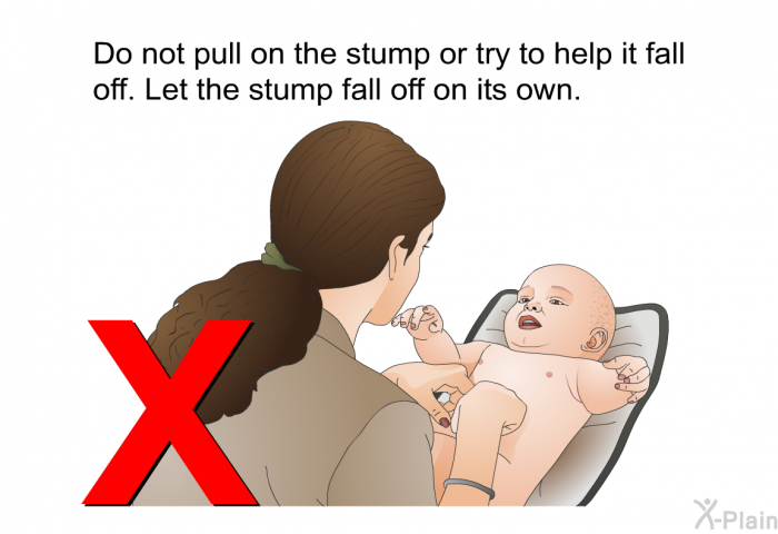 Do not pull on the stump or try to help it fall off. Let the stump fall off on its own.