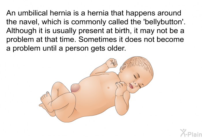 An umbilical hernia is a hernia that happens around the navel, which is commonly called the bellybutton. Although it is usually present at birth, it may not be a problem at that time. Sometimes it does not become a problem until a person gets older.