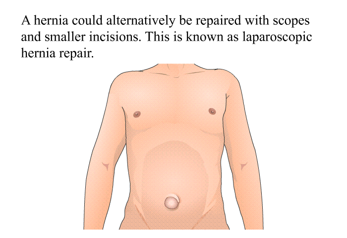 A hernia could alternatively be repaired with scopes and smaller incisions. This is known as laparoscopic hernia repair.