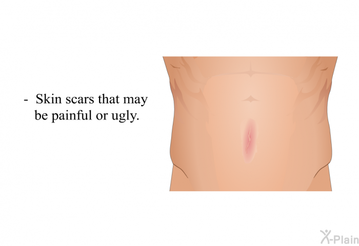 Skin scars that may be painful or ugly.