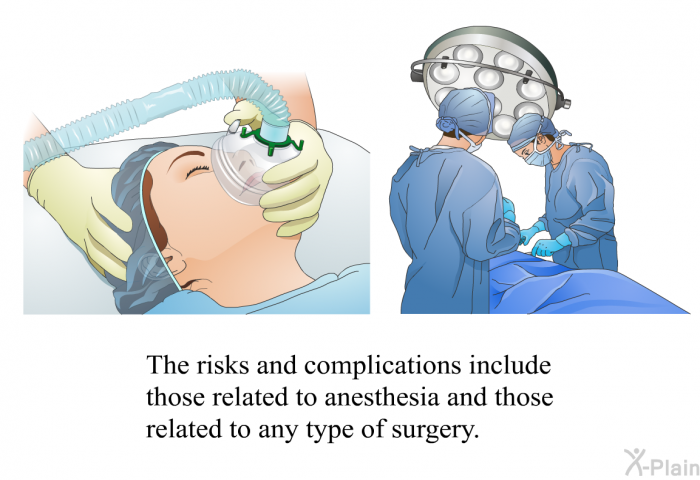 The risks and complications include those related to anesthesia and those related to any type of surgery.
