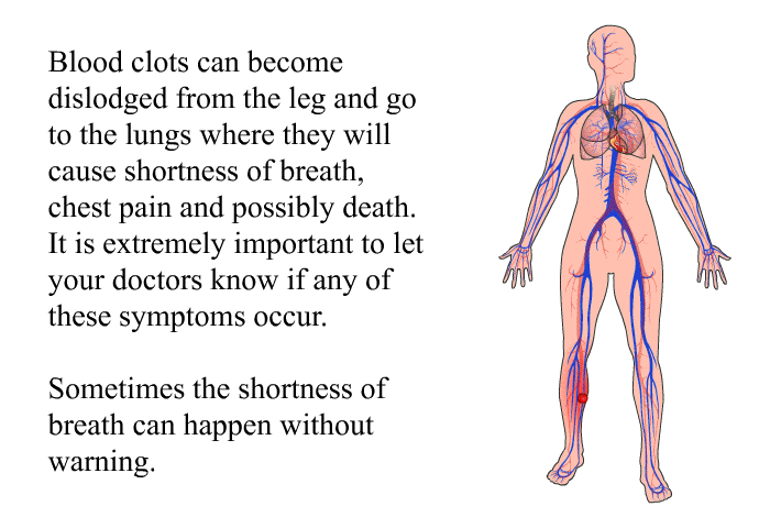 Blood clots can become dislodged from the leg and go to the lungs where they will cause shortness of breath, chest pain and possibly death. It is extremely important to let your doctors know if any of these symptoms occur. 
 Sometimes the shortness of breath can happen without warning.