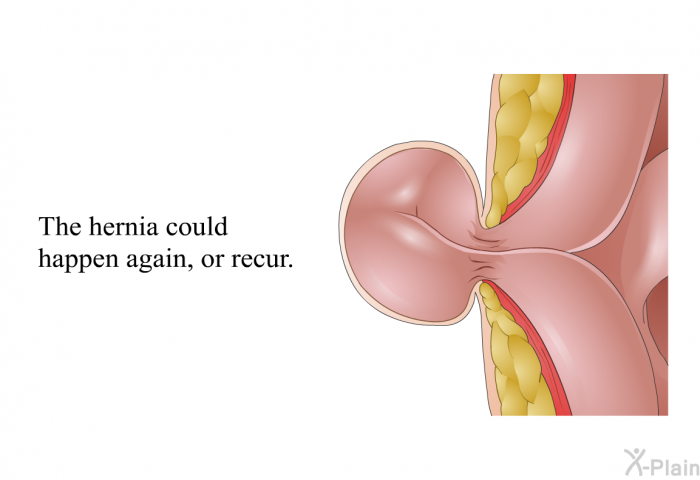 The hernia could happen again, or recur.