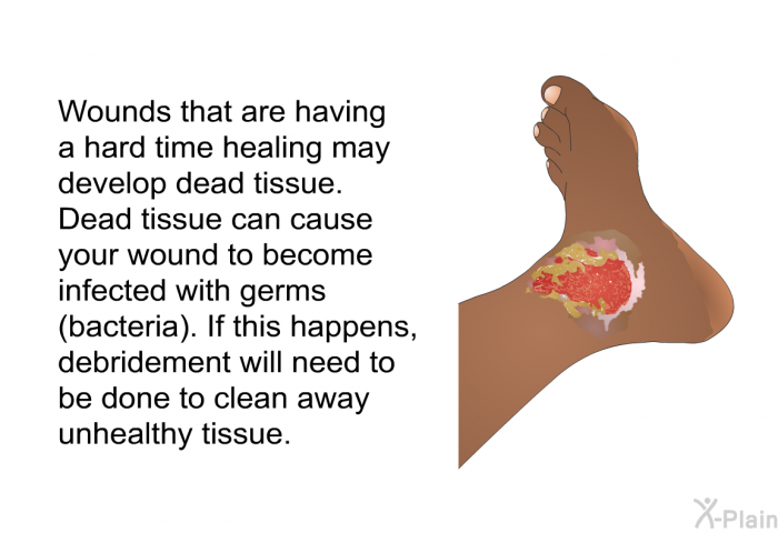 Wounds that are having a hard time healing may develop dead tissue. Dead tissue can cause your wound to become infected with germs (bacteria). If this happens, debridement will need to be done to clean away unhealthy tissue.