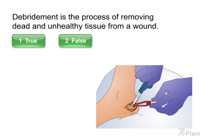 Debridement is the process of removing dead and unhealthy tissue from a wound.